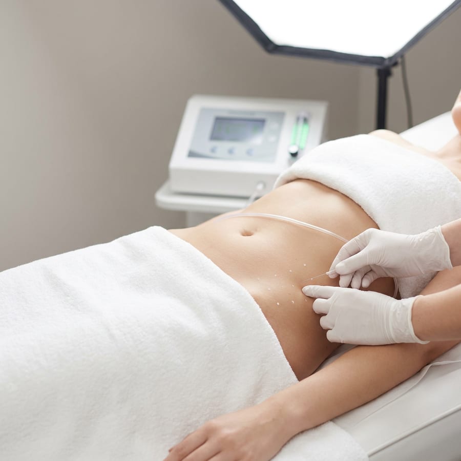 Carboxiterapia en Sabadell — LP Clinics